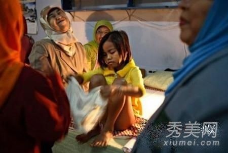 印尼令人发指的女子割礼术 性器官该割吗