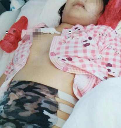 南阳19岁花季少女因做阑尾炎手术在医院死亡